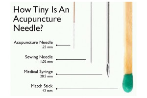 Acupunture 101 | The Non Toxic Lifestyle